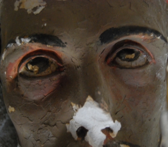 Malattie, sintomi e sindromi